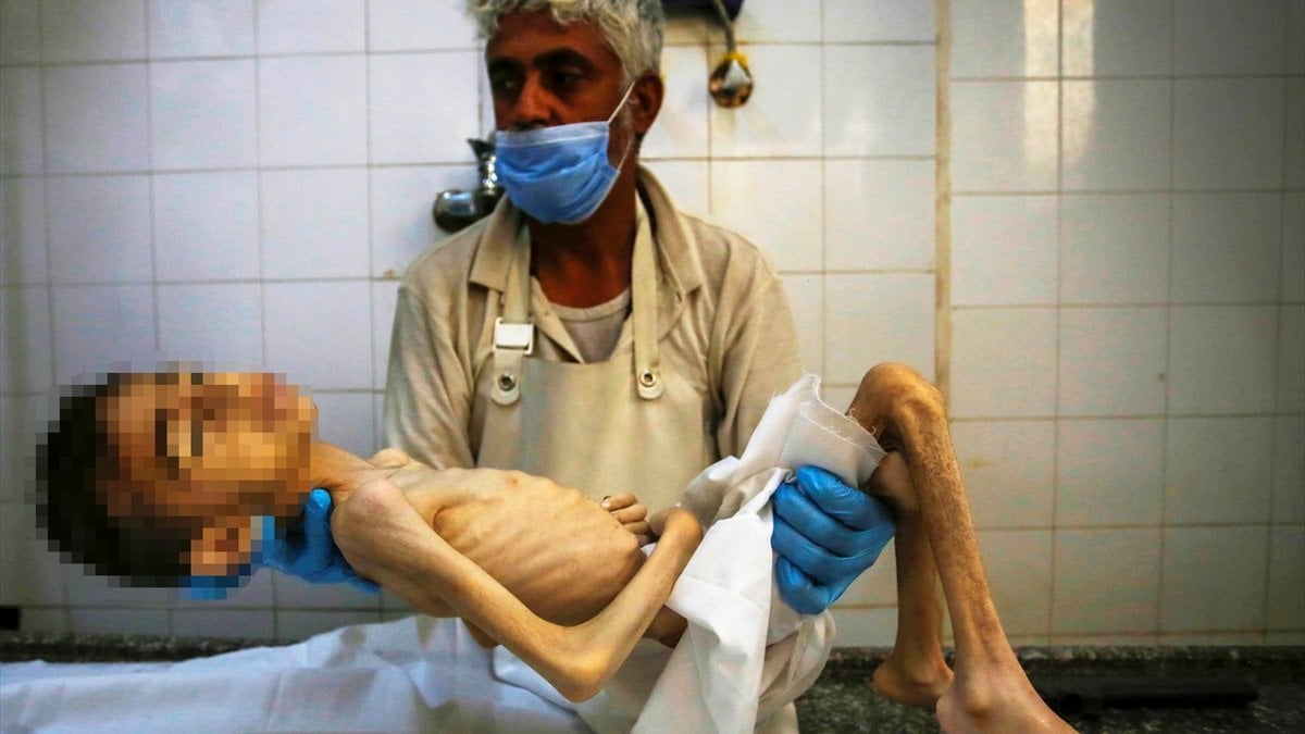 Gazze’de insanlık açlıktan ölüyor!